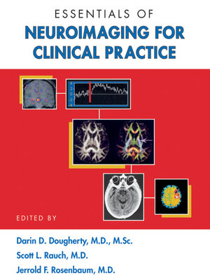cover image of Essentials of Neuroimaging for Clinical Practice